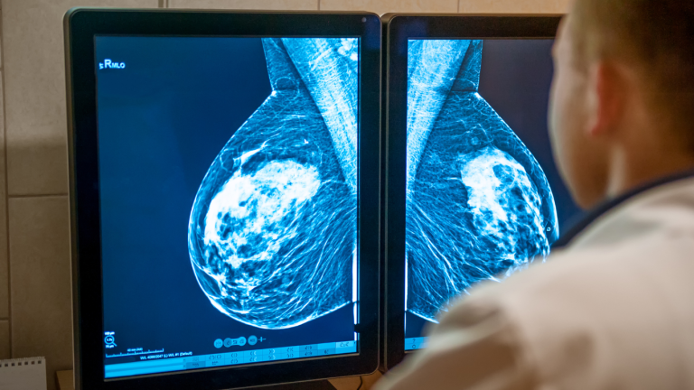 Médico observa una mamografía con tecnología de nanotecnología